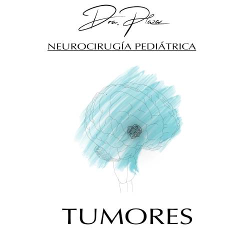 tumores cerebrales neurocirugia infantil